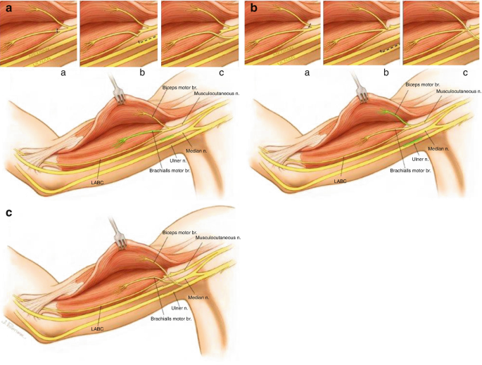 figure 22