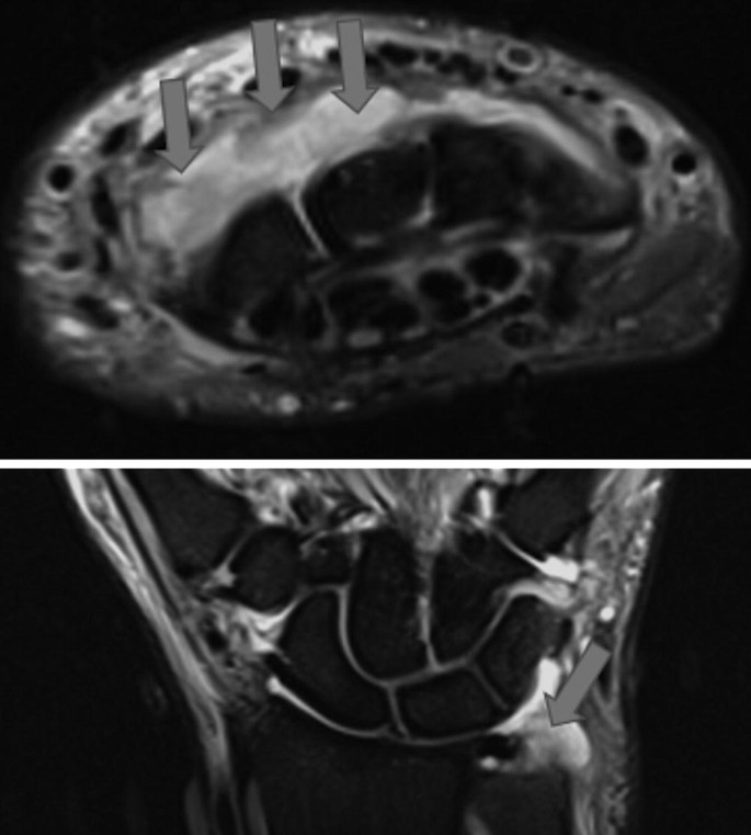 figure 22