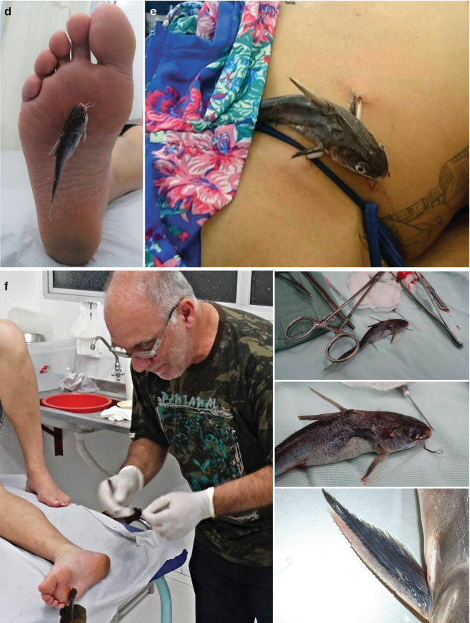 Injuries by Aquatic Vertebrate Animals
