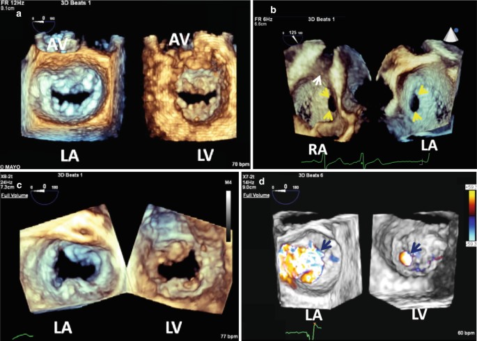 figure 16