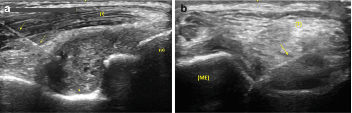 figure 41