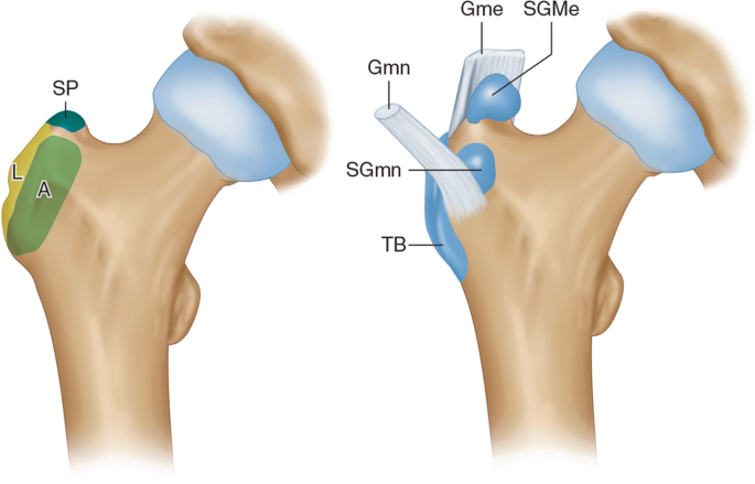 Hip Soft Tissue Injuries | SpringerLink