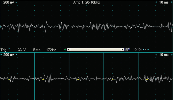 figure 17