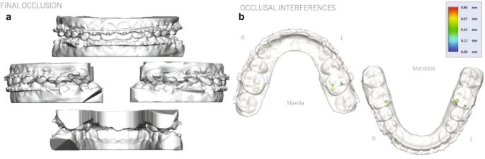 figure 14