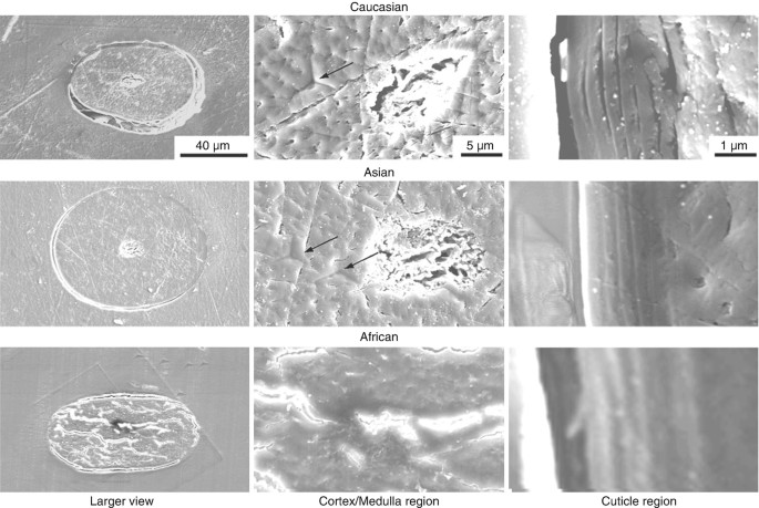 The Morphology and Structure of the Hair Shaft | SpringerLink The Morphology and Structure of the Hair Shaft | SpringerLink