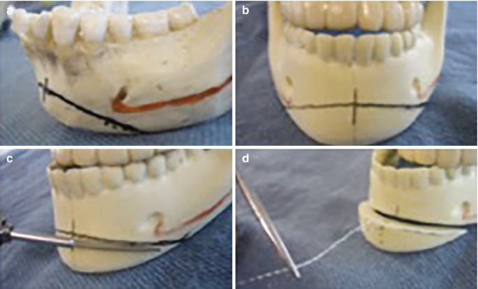 figure 24