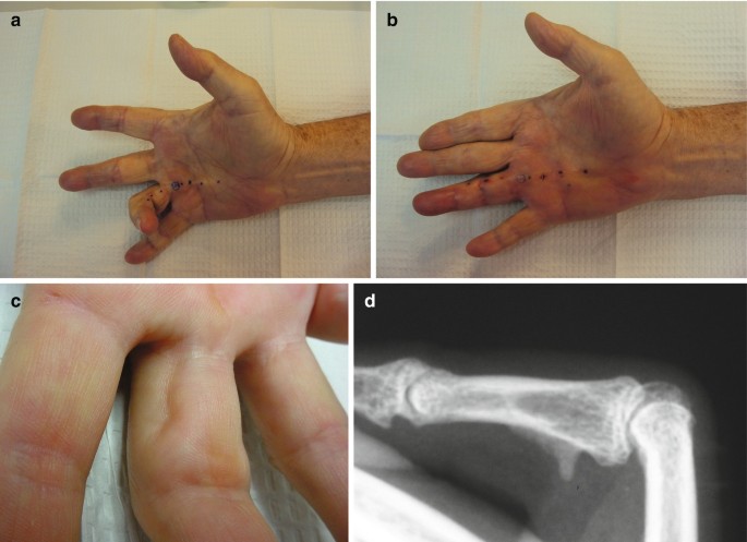 https://media.springernature.com/lw685/springer-static/image/chp%3A10.1007%2F978-3-030-78028-9_41/MediaObjects/478159_1_En_41_Fig5_HTML.jpg