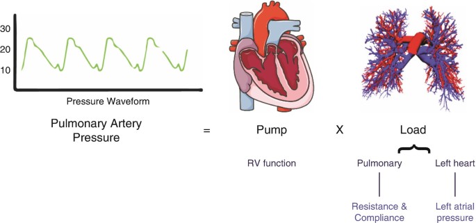 Right Ventricular Structure and Function During Exercise | SpringerLink