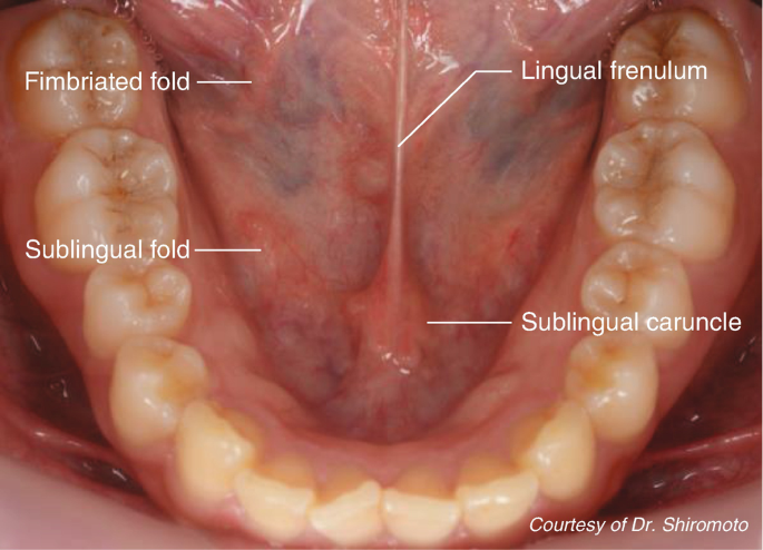 sublingual caruncle dog