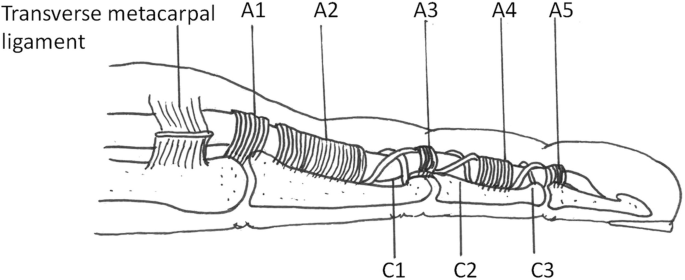 PDF) Topographic Description of Metacarpal Tendons and Ligaments of Anatoly  Donkey by Ultrasonography and Introducing a New Ligament