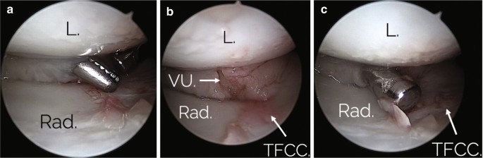 figure 32