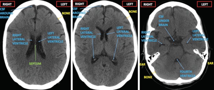 Understanding Your Brain Imaging | SpringerLink