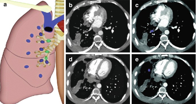 figure 26