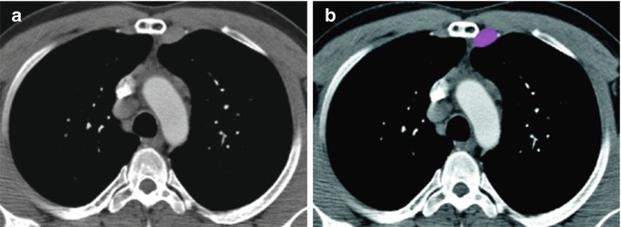 figure 37