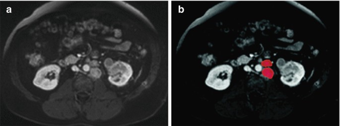 figure 31