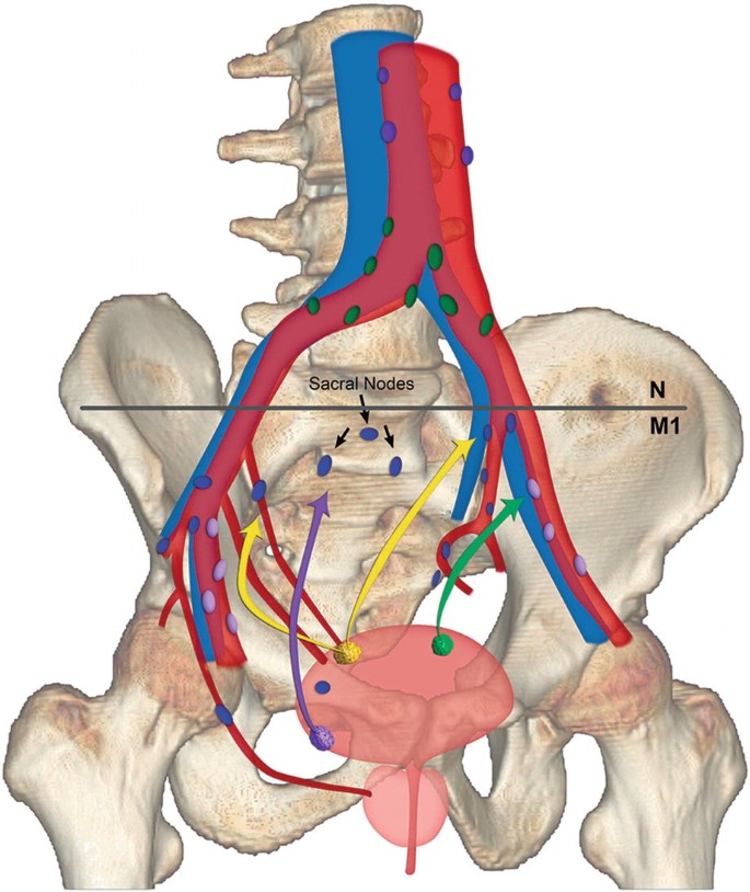 Pelvic Lymph Node Anatomy | SpringerLink
