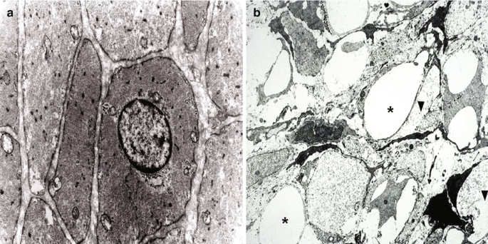 A set of two microscopic views of muscle cells with M M I H S.