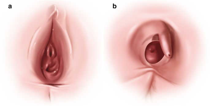 preteen clitoris Five things you should know about the clitoris