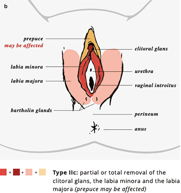 clit cut off Save a Girl Save a Generation