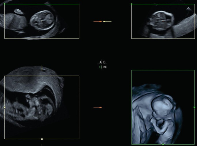 Fetal doppler : 427 images, photos de stock, objets 3D et images