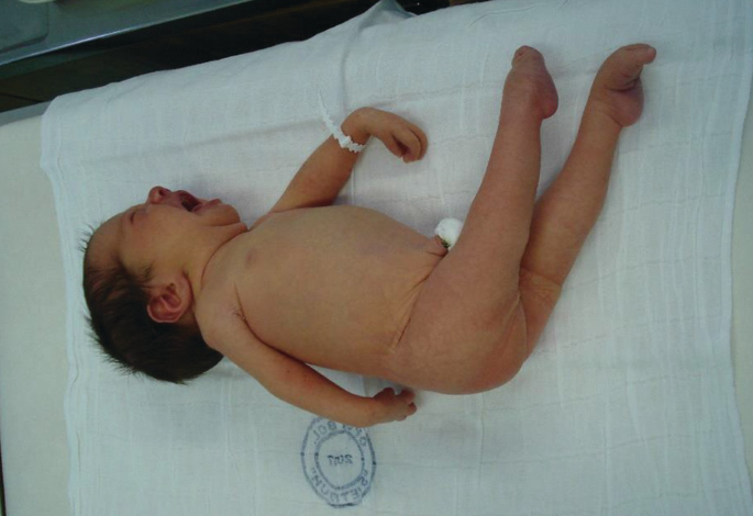 Caring For The Normal Newborn Springerlink
