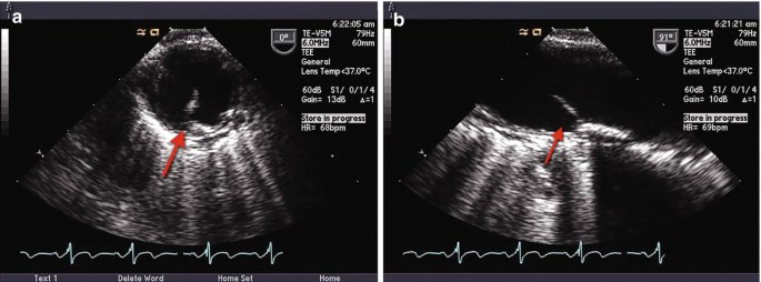 figure 21