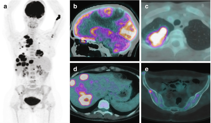 https://media.springernature.com/lw685/springer-static/image/chp%3A10.1007%2F978-3-030-84546-9_9/MediaObjects/493516_1_En_9_Fig5_HTML.png