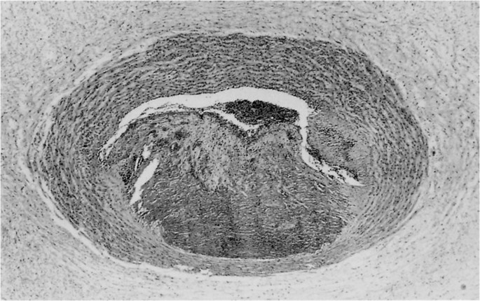 Anatomy and Pathology of the Umbilical Cord | SpringerLink