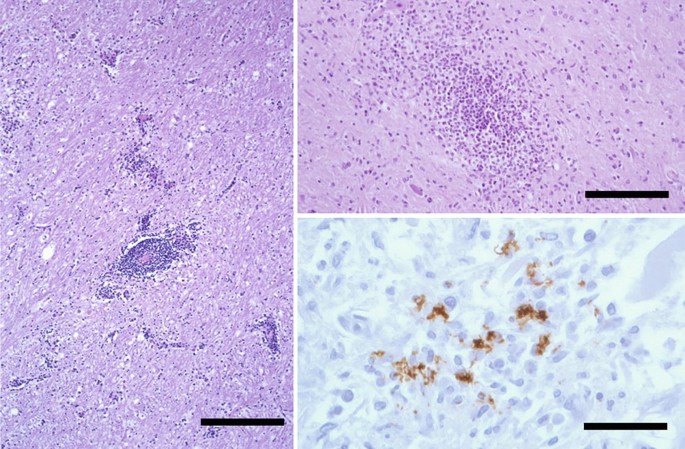 Global Collaboration for Food Safety