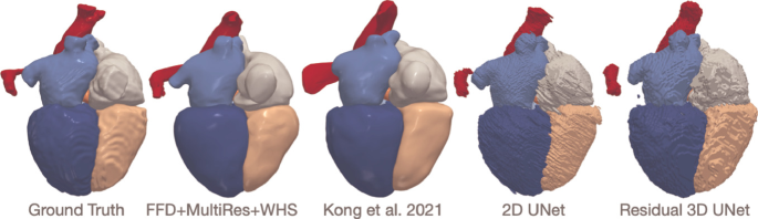 Whole Heart Mesh Generation for Image-Based Computational Simulations by  Learning Free-From Deformations