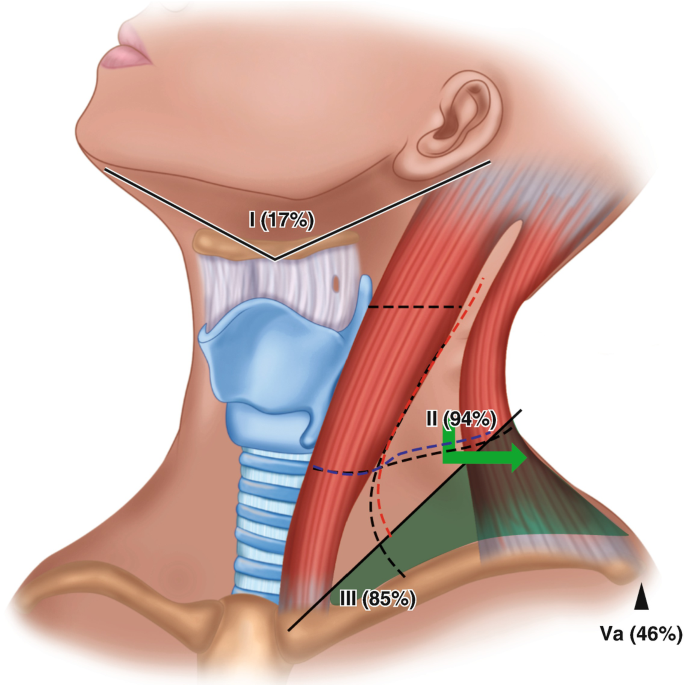 Head And Neck Cancers Springerlink