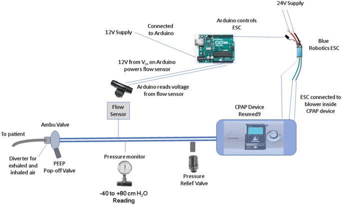 CPAP-to-Ventilator: Open-Source Documentation, UC Irvine | SpringerLink