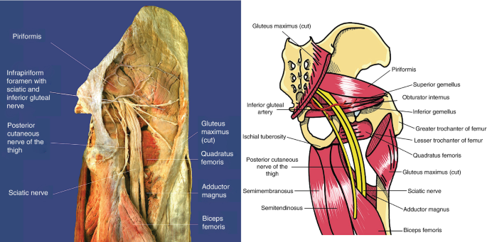 superior gluteal nerve injection