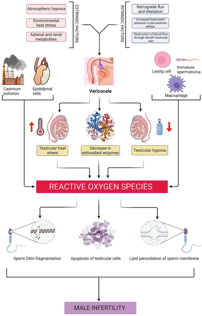 Oxidative Stress and Varicocele-Associated Male Infertility
