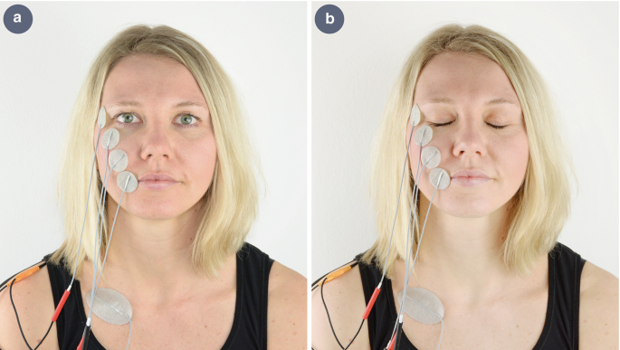 IFT + FACIAL Stimulator for Bell's Palsy - Techno Health