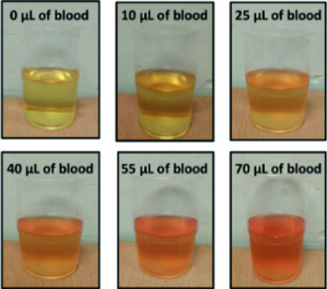 Low-Cost Sensor to Detect the Blood in Urine | SpringerLink