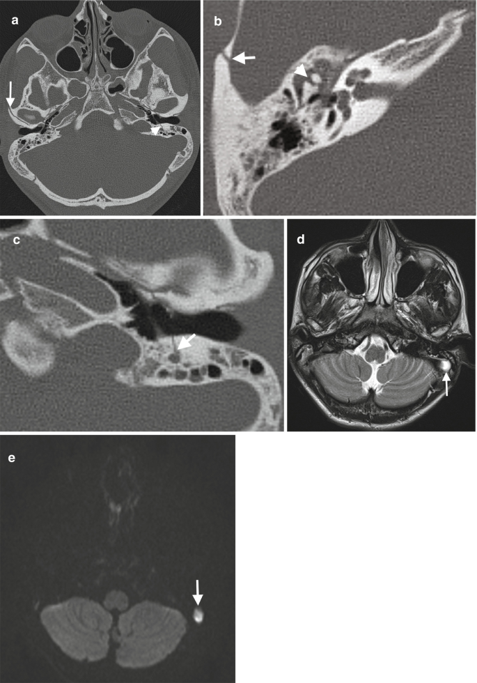 figure 18