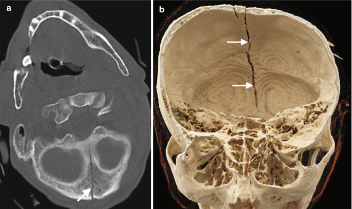 figure 28