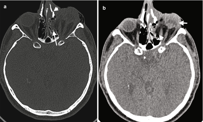 figure 33