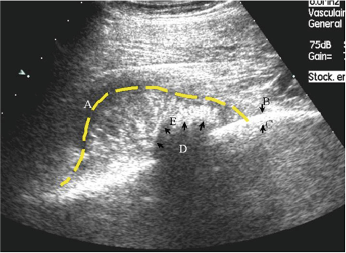 Ultrasound Computed Tomography | SpringerLink