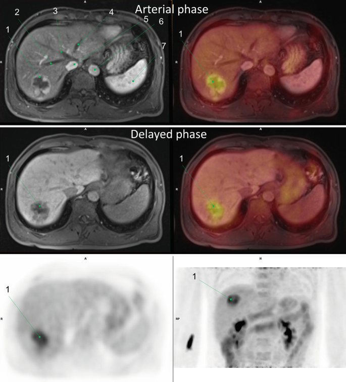 figure 28