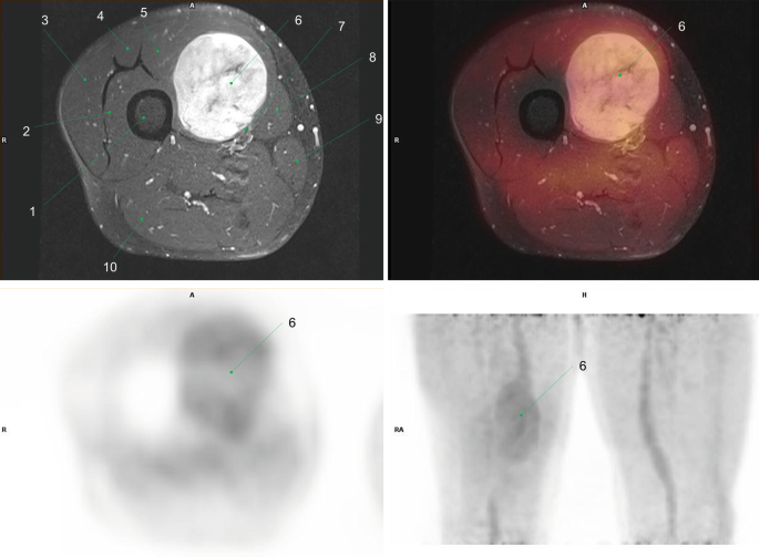 figure 48