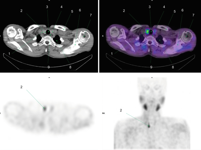 figure 34