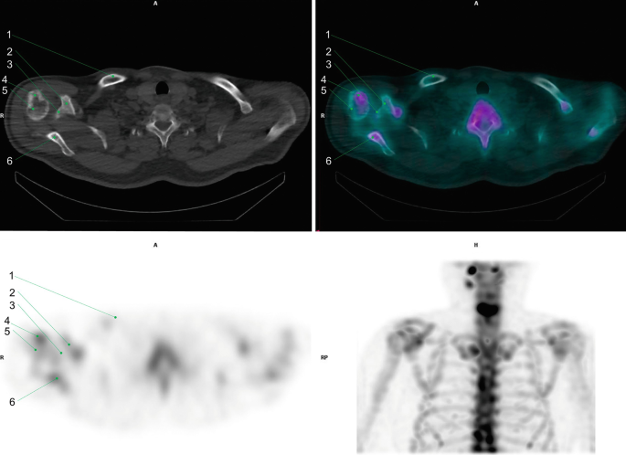 figure 54