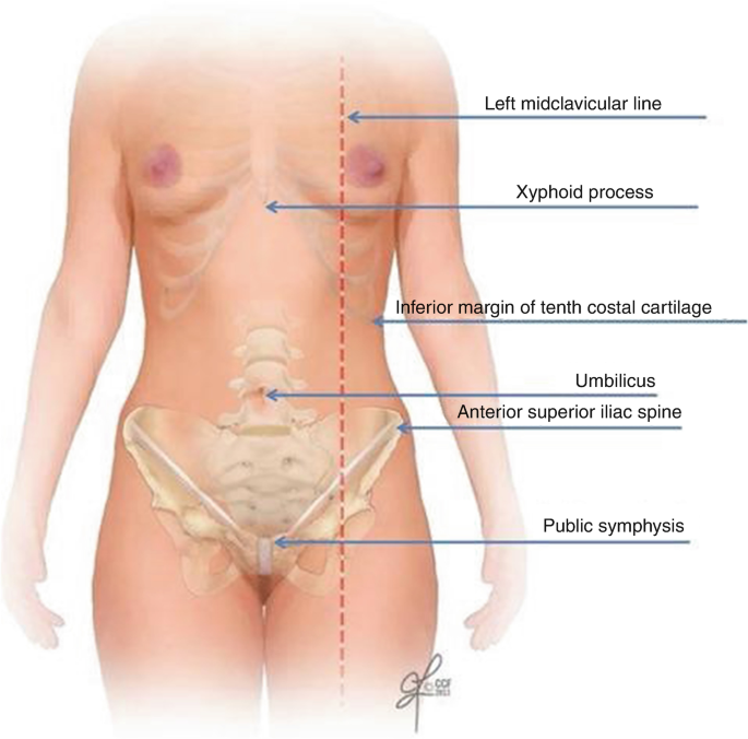 LAPAROSCOPY Origin: Greek Lapara- the soft parts of the body between the  rib margins and hips- the flank or loin  Skopein, which means to see or  view. - ppt download