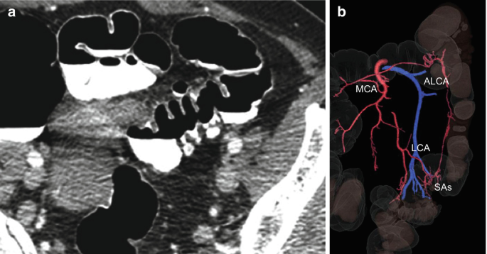 figure 16