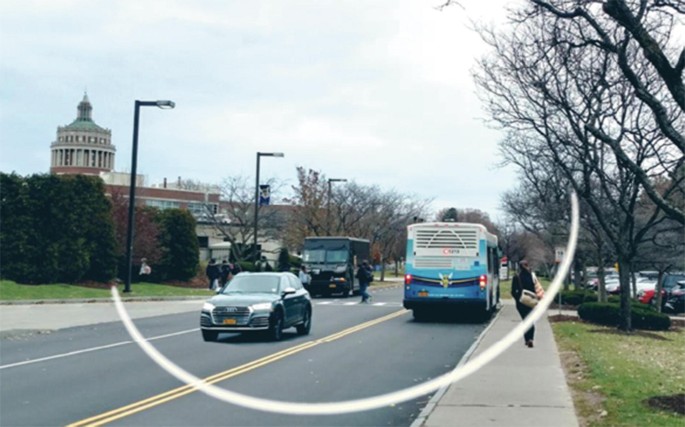 Prevention and Treatment of Negative and Positive Dysphotopsia | SpringerLink