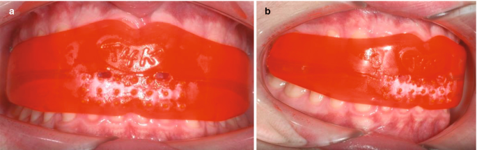 figure 30