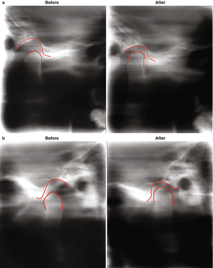 figure 35