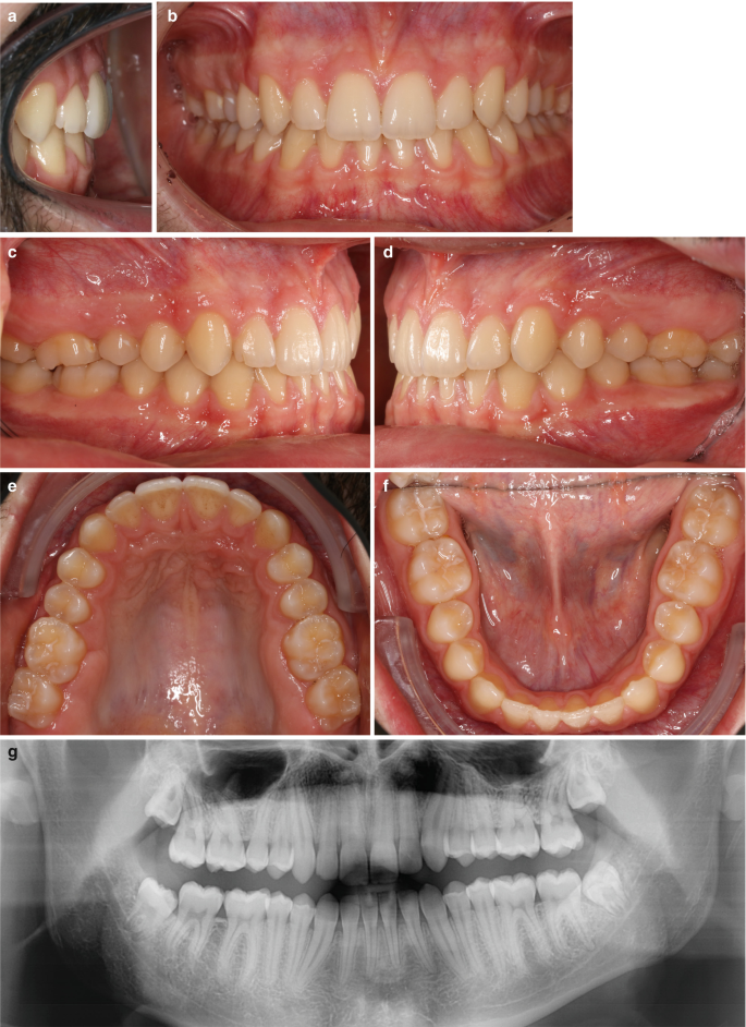 figure 58